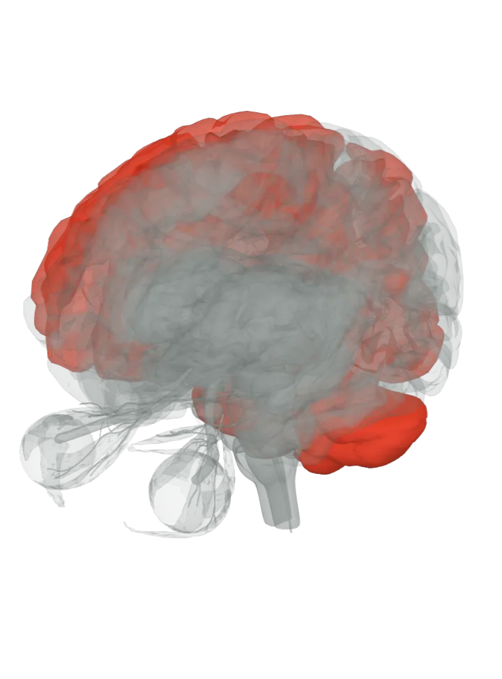 The superior parietal lobule, the middle frontal gyrus, the superior frontal gyrus, the cerebellum, the superior colliculus and the occipital lobe lit in red on a 3D model of the brain, seen from the front left and above