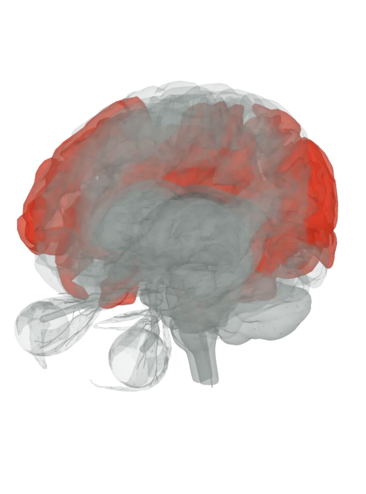 The occipital lobe, the fusiform gyrus, the superior temporal gyrus, the angular gyrus, the supramarginal gyrus, the superior parietal lobule, the middle frontal gyrus, the inferior frontal gyrus and the cingulate gyrus lit in red on a 3D model of the brain, seen from the front left and above