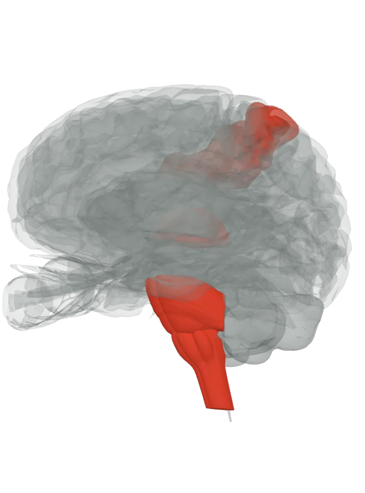 The whole trigeminal pathway lit in red, from the trigeminal nerve (CN V), which lies against the pons, to the postcentral gyrus: the pons, medulla oblongata, thalamus and postcentral gyrus, on a 3D model of the brain, seen from the front left