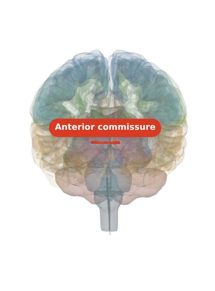 The anterior commissure lit in red on a 3D model of the brain cut by a front (coronal) slice, seen from the front