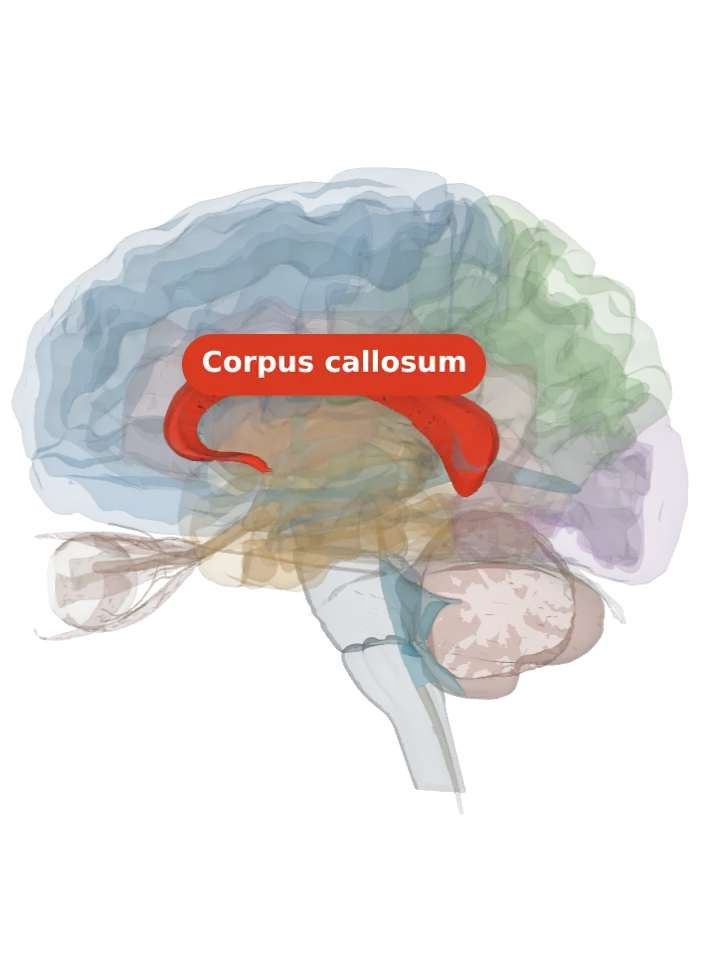 The corpus callosum lit in red on a 3D model of the brain cut by a side (sagittal) slice, seen from the left
