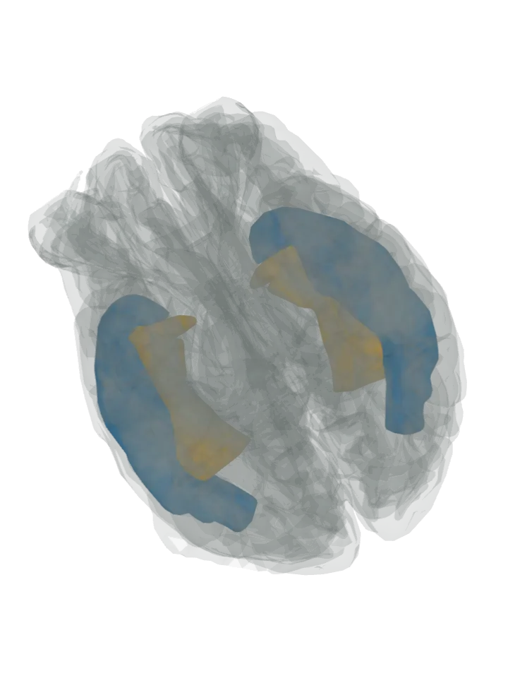 The inferior temporal gyrus lit in blue and the fusiform gyrus lit in orange on a 3D model of the brain cut by a top (axial) slice, seen from above
